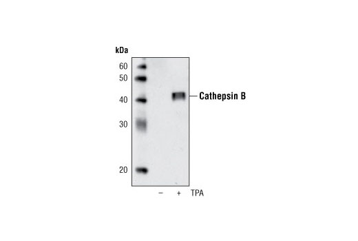 Western Blotting Image 1: Cathepsin B (G60) Antibody
