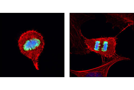 Immunofluorescence Image 1: Phospho-Histone H3 (Ser10) (D2C8) XP® Rabbit mAb