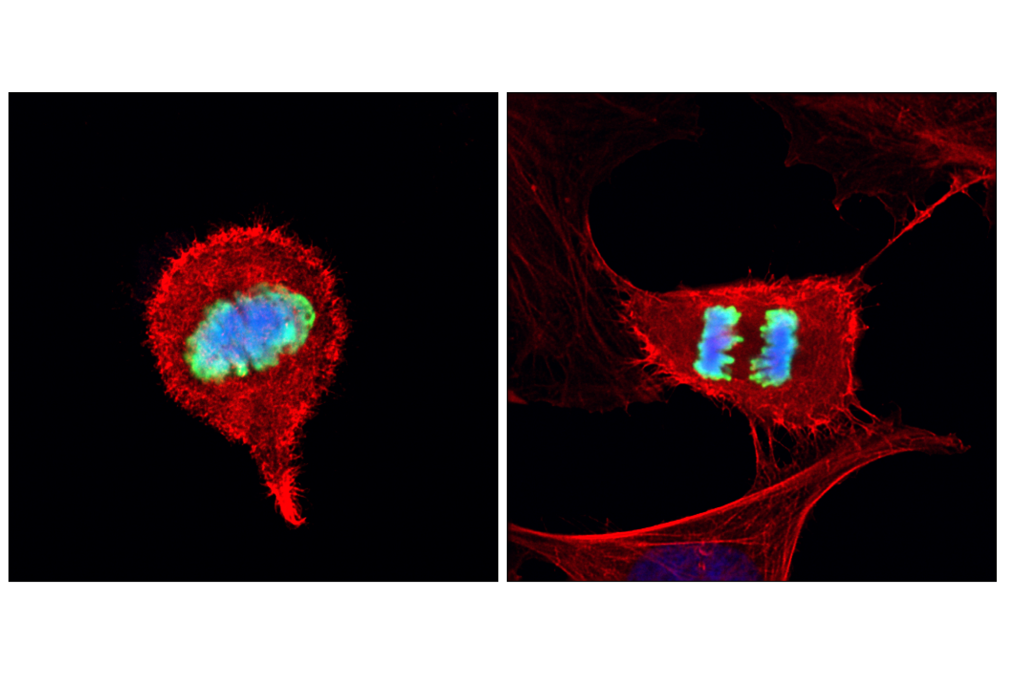 Immunofluorescence Image 1: Phospho-Histone H3 (Ser10) (D2C8) Rabbit Monoclonal Antibody