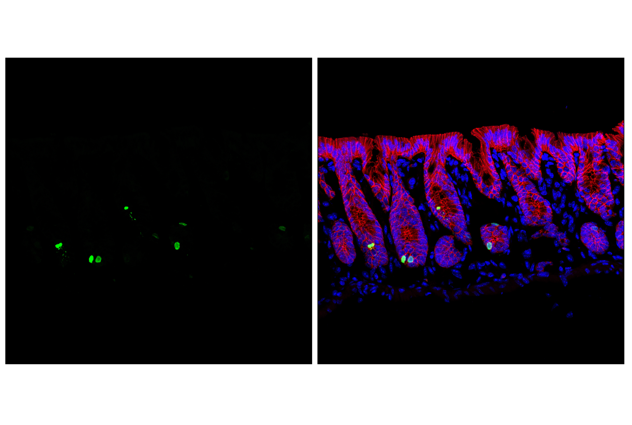 Immunofluorescence Image 1: Phospho-Histone H3 (Ser10) (D2C8) Rabbit Monoclonal Antibody