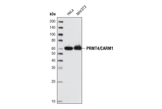  Image 4: PRMT Antibody Sampler Kit