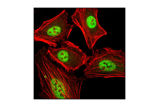 Immunofluorescence Image 1: PRMT4/CARM1 (C31G9) Rabbit mAb
