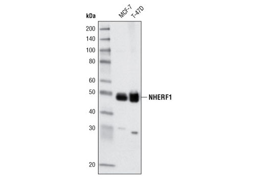 Western Blotting Image 1: NHERF1 (A140) Antibody