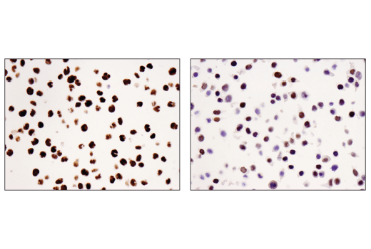 Immunohistochemistry Image 1: WHSC1L1 (D4N9N) Rabbit mAb (BSA and Azide Free)