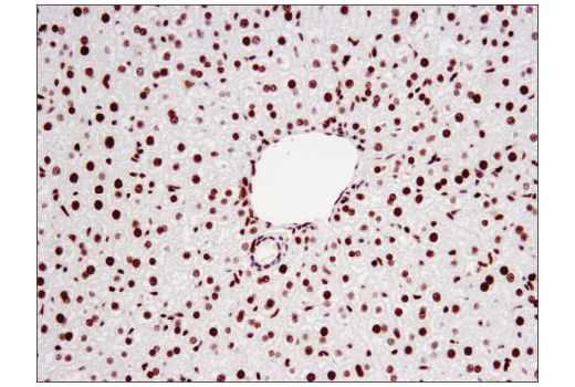 Immunohistochemistry Image 2: WHSC1L1 (D4N9N) Rabbit mAb (BSA and Azide Free)