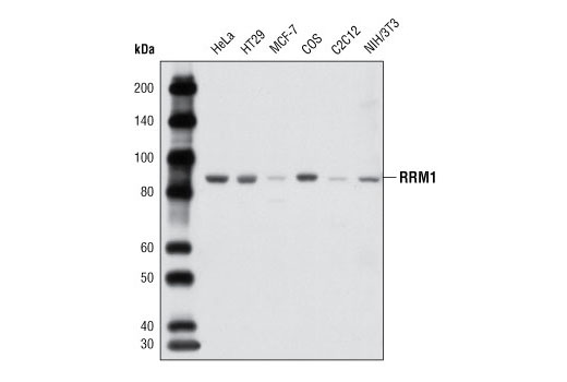 Western Blotting Image 1: RRM1 Antibody
