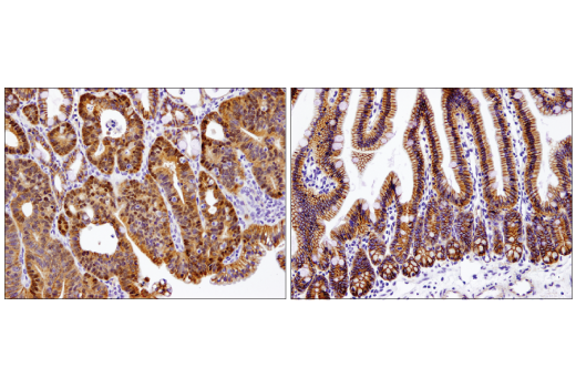 Immunohistochemistry Image 1: Non-phospho (Active) β-Catenin (Ser33/37/Thr41) (D13A1) Rabbit mAb (BSA and Azide Free)