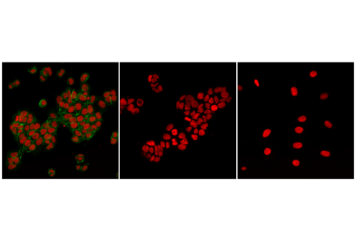 Immunofluorescence Image 1: Non-phospho (Active) β-Catenin (Ser33/37/Thr41) (D13A1) Rabbit mAb (BSA and Azide Free)