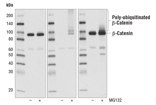 Western Blotting Image 2: Non-phospho (Active) β-Catenin (Ser33/37/Thr41) (D13A1) Rabbit mAb (BSA and Azide Free)