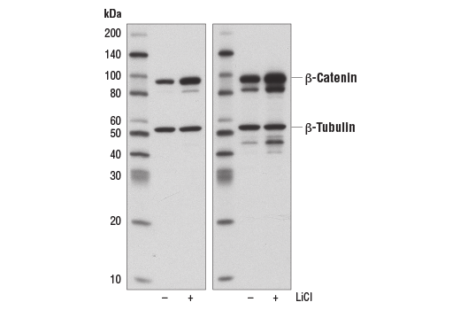 Western Blotting Image 3: Non-phospho (Active) β-Catenin (Ser33/37/Thr41) (D13A1) Rabbit mAb (BSA and Azide Free)