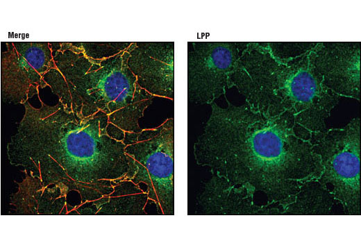 Immunofluorescence Image 1: LPP (8B3A11) Mouse mAb