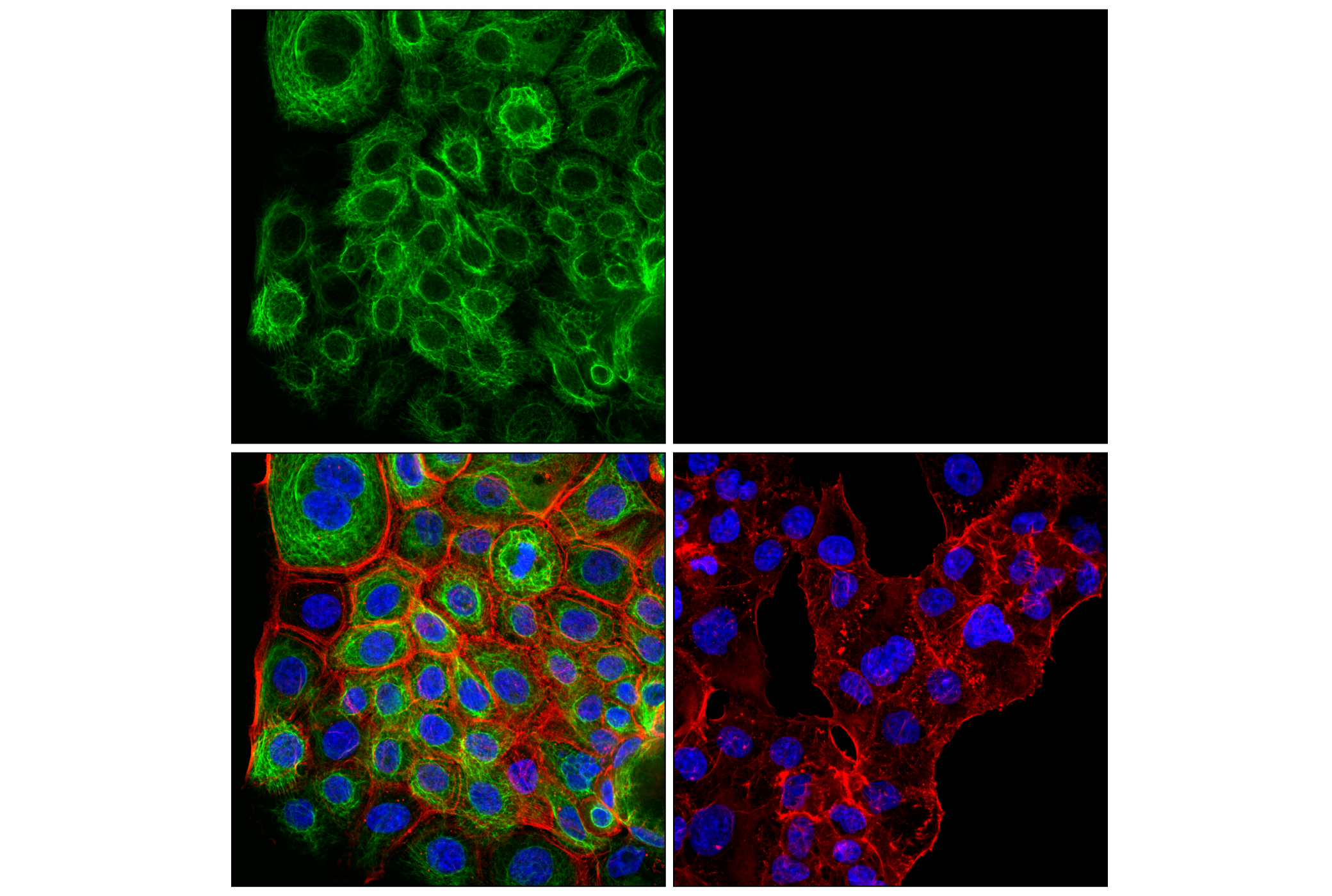 Immunofluorescence Image 2: Keratin 5 (E2T4B) XP® Rabbit mAb (Alexa Fluor® 488 Conjugate)