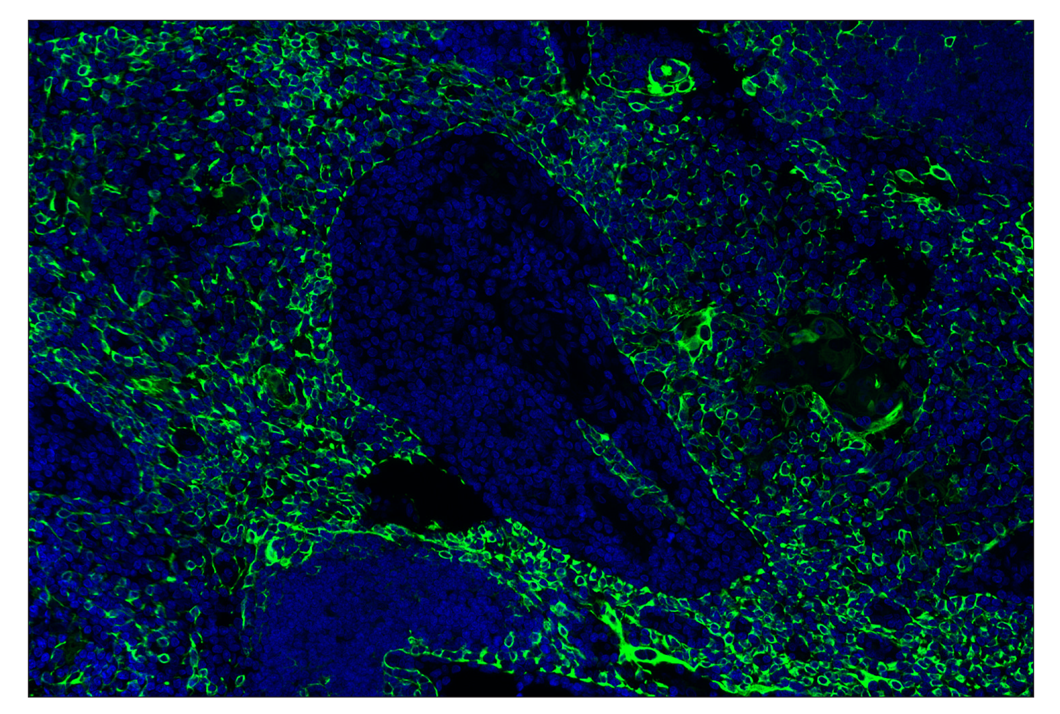 Immunohistochemistry Image 2: Keratin 5 (E2T4B) XP® Rabbit mAb (Alexa Fluor® 488 Conjugate)
