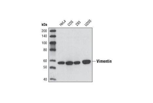 Western Blotting Image 2: Vimentin (5G3F10) Mouse mAb