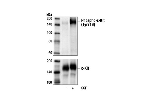 Western Blotting Image 1: Phospho-c-Kit (Tyr719) Antibody