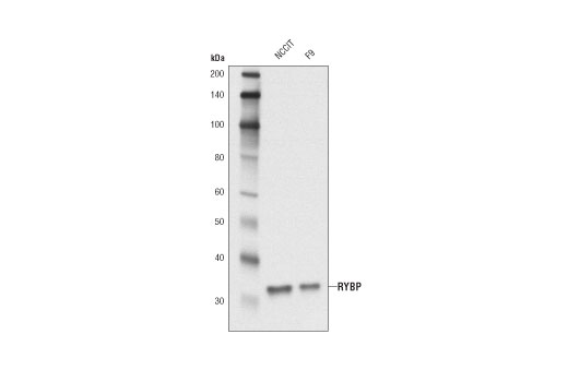 Western Blotting Image 1: RYBP Antibody