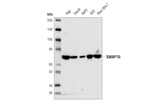 Western Blotting Image 1: SWAP70 (D5O6A) Rabbit mAb