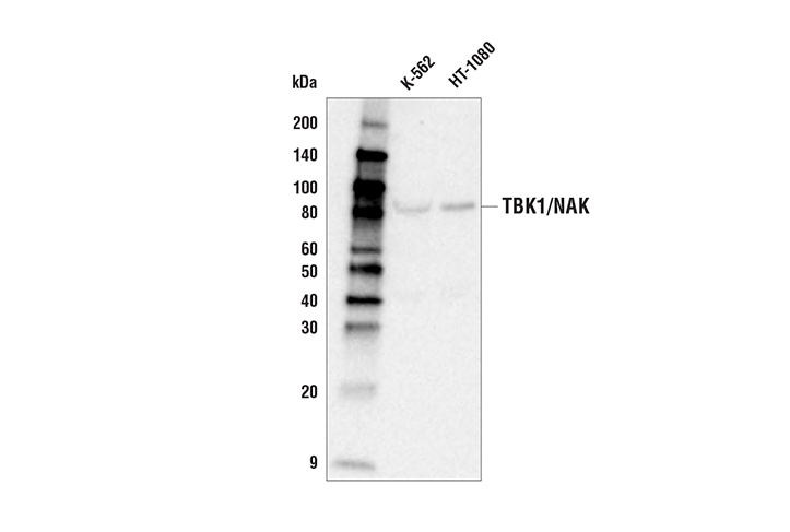 Western Blotting Image 1: TBK1/NAK (D1B4) Rabbit mAb (Biotinylated)