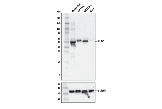  Image 3: Tau Mouse Model Neuronal Viability IF Antibody Sampler Kit