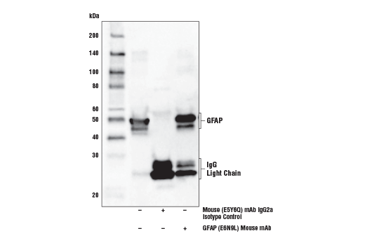 Immunoprecipitation Image 1: GFAP (E6N9L) Mouse mAb