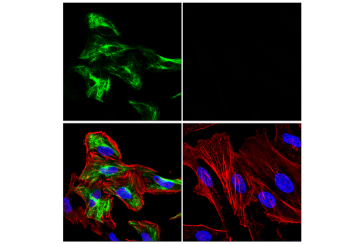 Immunofluorescence Image 2: GFAP (E6N9L) Mouse mAb