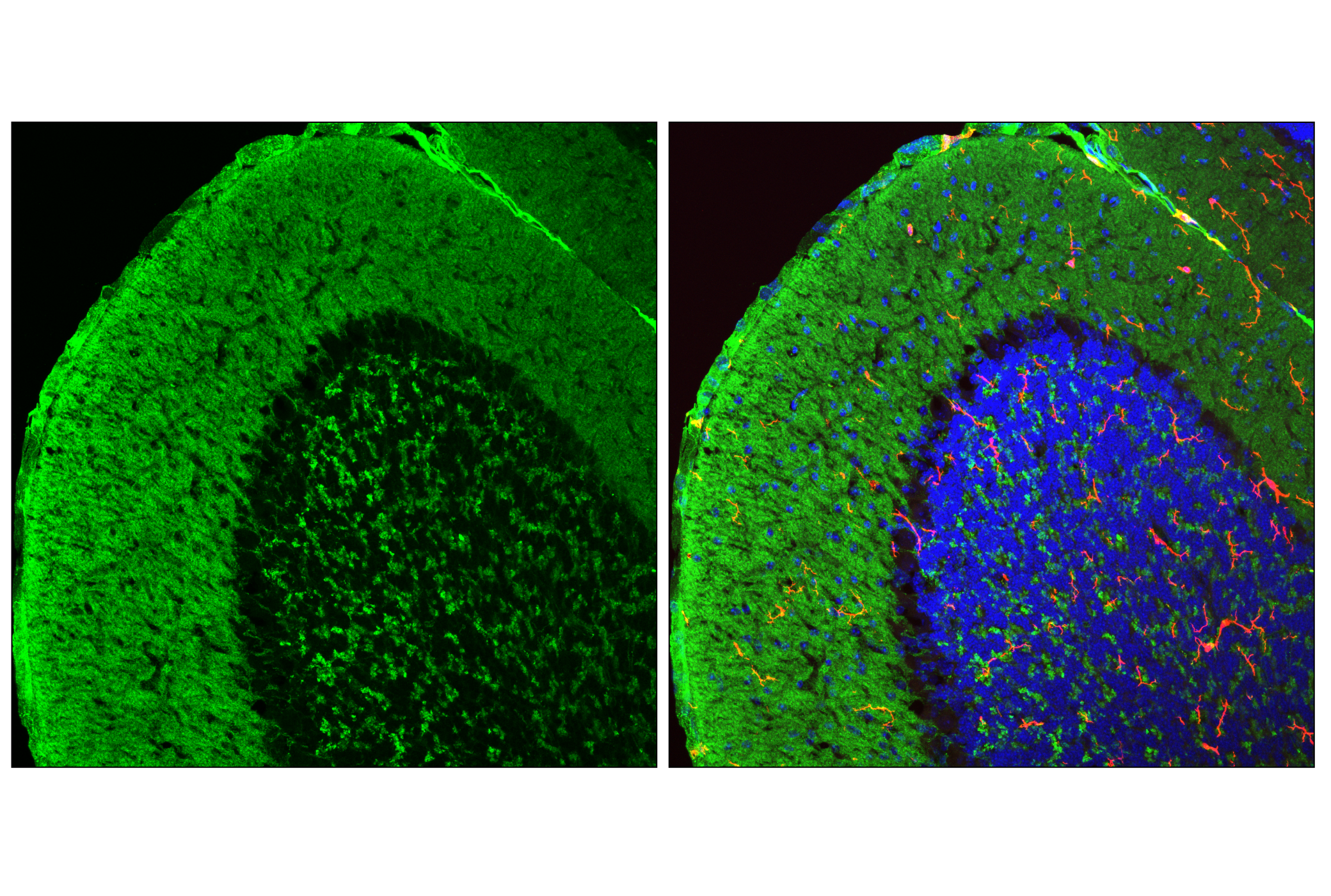 Immunofluorescence Image 1: VGLUT1 (E9D2B) Mouse mAb (BSA and Azide Free)