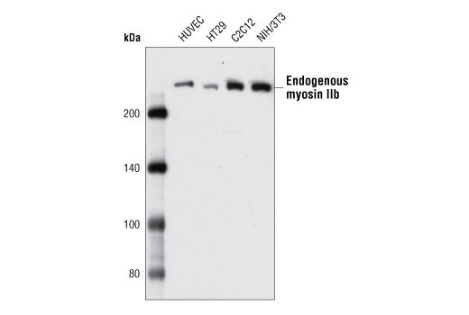 Western Blotting Image 2: Myosin IIb Antibody