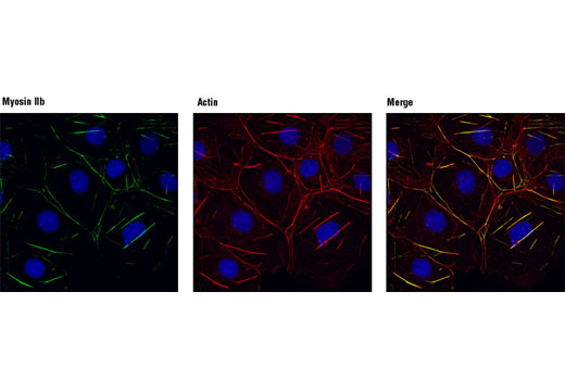 Immunofluorescence Image 1: Myosin IIb Antibody
