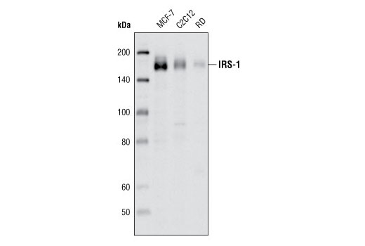  Image 6: IRS-1 Inhibition Antibody Sampler Kit