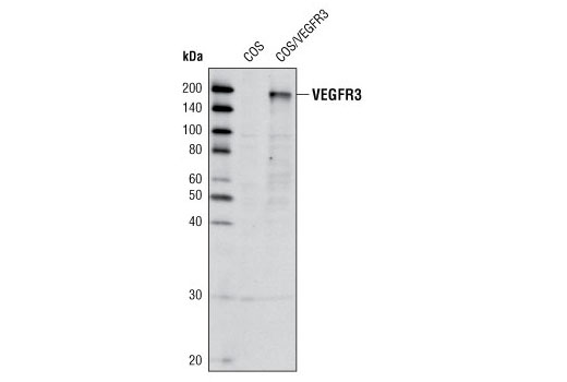 Western Blotting Image 1: VEGF Receptor 3 (C82A2) Rabbit mAb