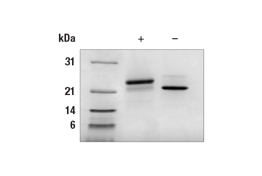  Image 1: Human Growth Hormone Recombinant Protein