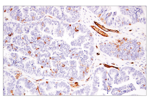 Immunohistochemistry Image 5: CD141/Thrombomodulin (E7Y9P) XP® Rabbit mAb (BSA and Azide Free)