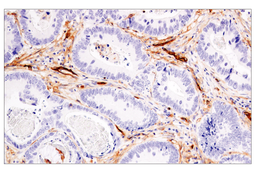 Immunohistochemistry Image 7: CD141/Thrombomodulin (E7Y9P) XP® Rabbit mAb (BSA and Azide Free)