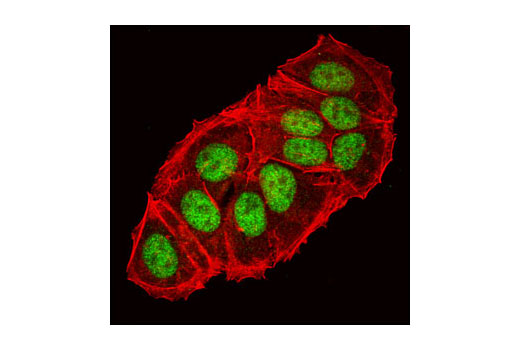 Immunofluorescence Image 1: HIF-1β/ARNT (C15A11) Rabbit mAb