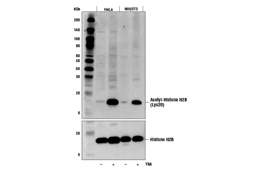 Western Blotting Image 1: Acetyl-Histone H2B (Lys20) (D7O9W) Rabbit mAb