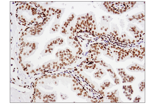 Immunohistochemistry Image 4: Acetyl-Histone H2B (Lys20) (D7O9W) Rabbit mAb