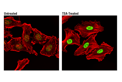 Immunofluorescence Image 1: Acetyl-Histone H2B (Lys20) (D7O9W) Rabbit mAb