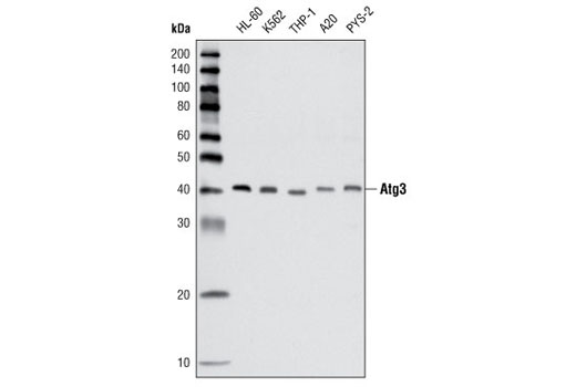  Image 5: Autophagy Vesicle Elongation (LC3 Conjugation) Antibody Sampler Kit