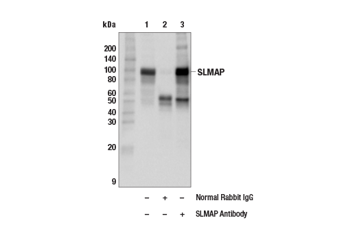 Immunoprecipitation Image 1: SLMAP Antibody