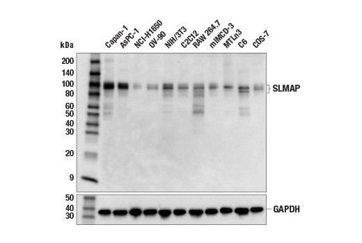 Western Blotting Image 1: SLMAP Antibody