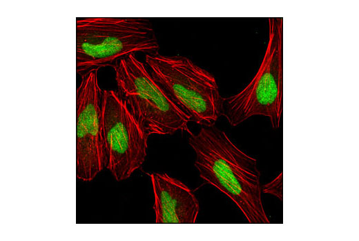 Immunofluorescence Image 1: CTCF (D1A7) XP® Rabbit mAb