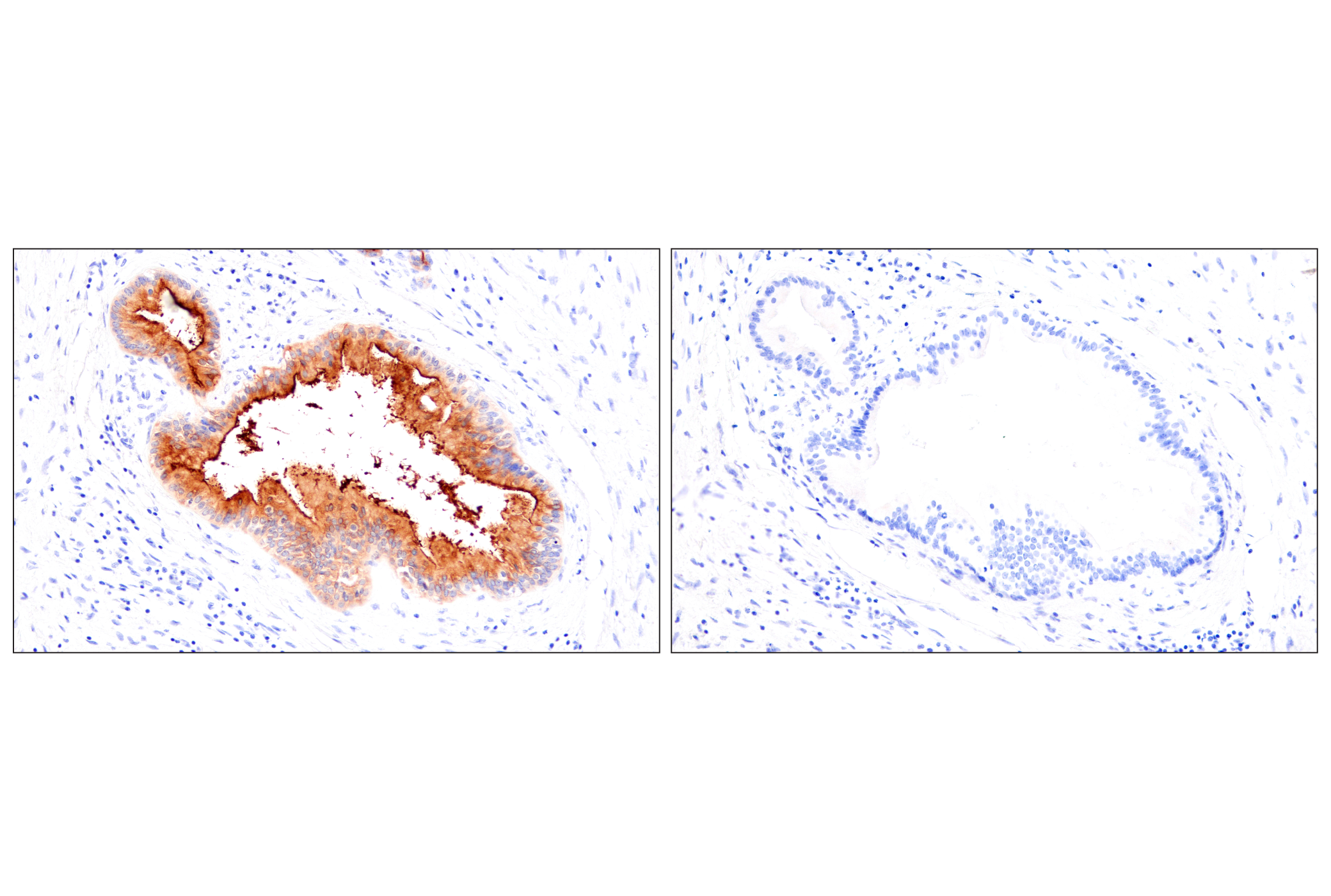 Immunohistochemistry Image 11: CEACAM7 (E5Q6X) Rabbit mAb (BSA and Azide Free)