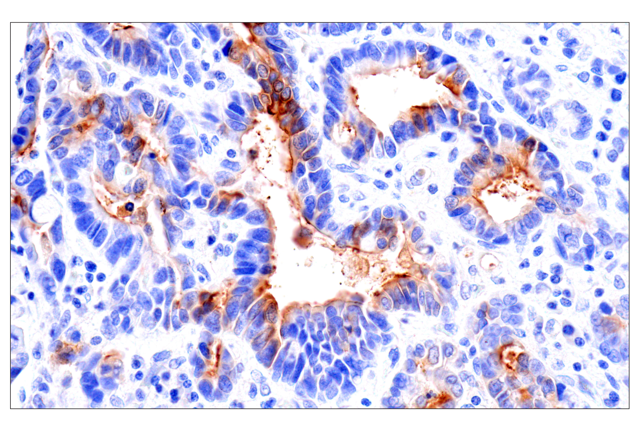 Immunohistochemistry Image 2: CEACAM7 (E5Q6X) Rabbit mAb (BSA and Azide Free)