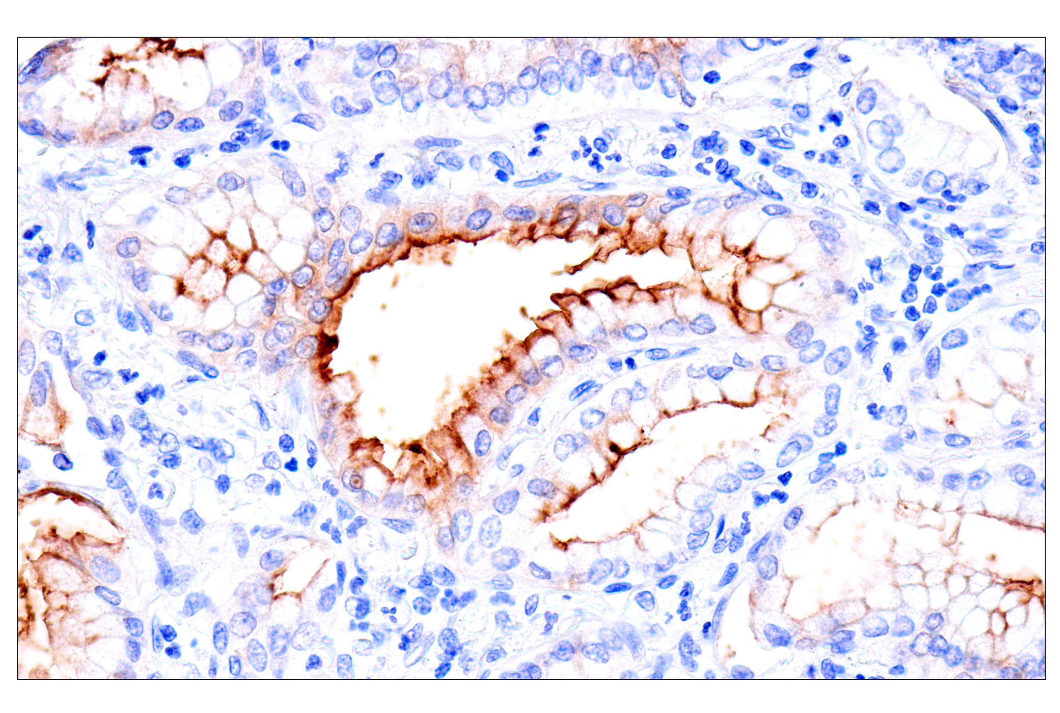 Immunohistochemistry Image 1: CEACAM7 (E5Q6X) Rabbit mAb (BSA and Azide Free)