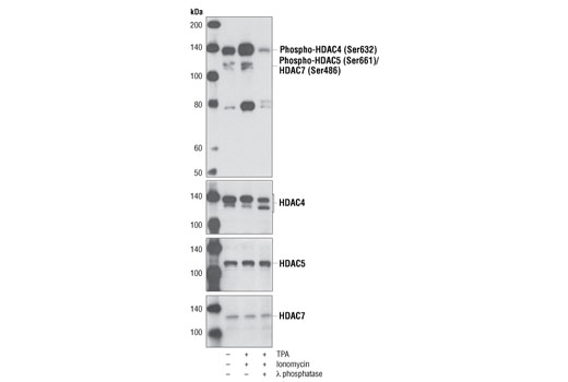 Western Blotting Image 1: Phospho-HDAC4 (Ser632)/HDAC5 (Ser661)/HDAC7 (Ser486) Antibody