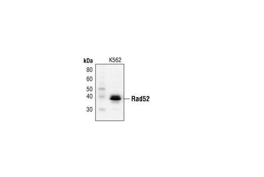 Western Blotting Image 1: Rad52 Antibody