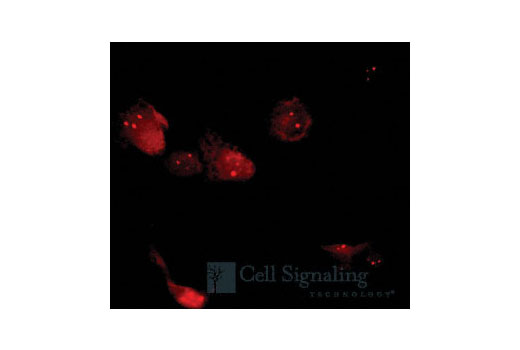 Immunofluorescence Image 1: Rad52 Antibody