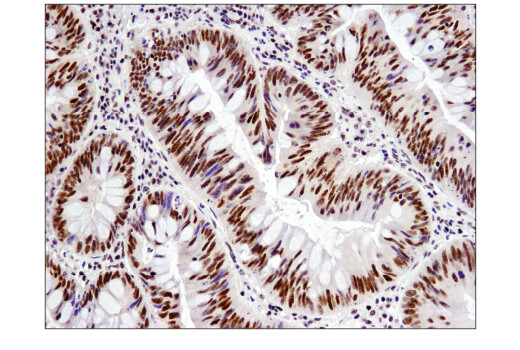 Immunohistochemistry Image 3: NCoR1 (E4S4N) Rabbit mAb