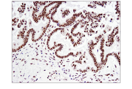 Immunohistochemistry Image 4: NCoR1 (E4S4N) Rabbit mAb