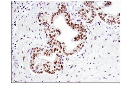 Immunohistochemistry Image 5: NCoR1 (E4S4N) Rabbit mAb